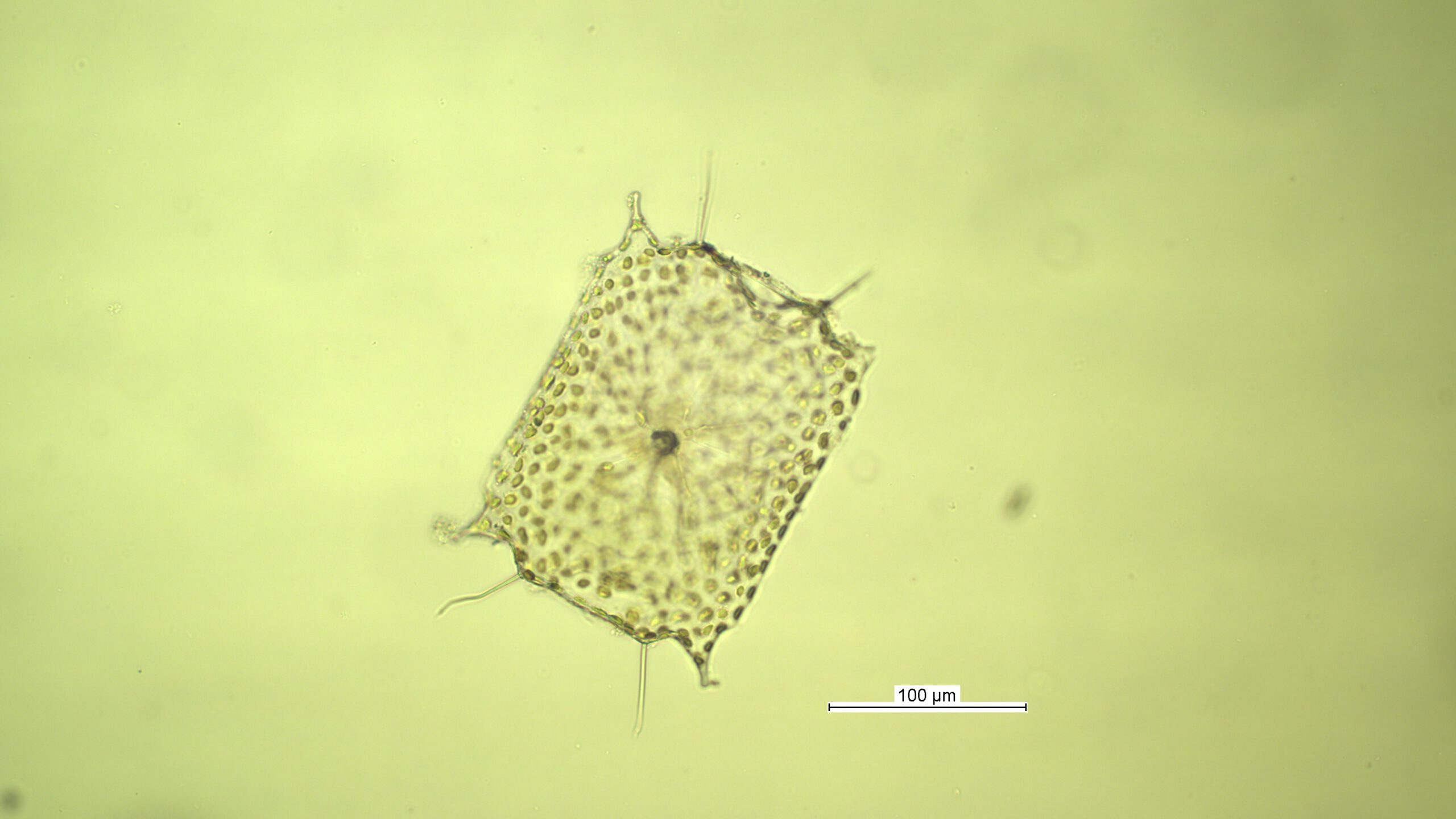 Plankton im Wattenmeer